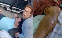 Pitbull saldırısında ölümden dönen adamın bacağına 28 dikiş atıldı! “Benden önce 5 kişiye daha saldırmış”